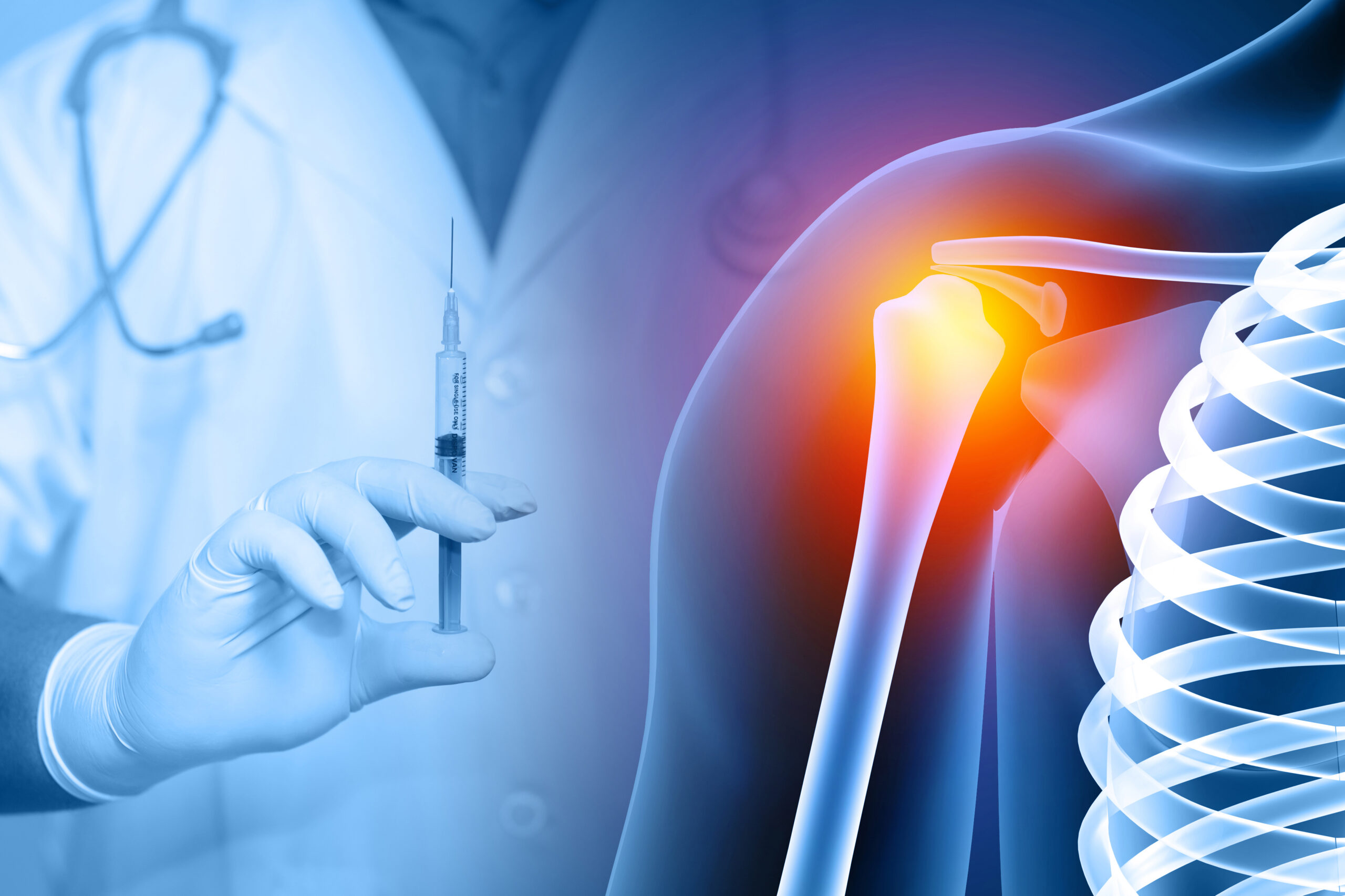 Shoulder Joint Injection, shoulder joint pain, x-ray view, shoulder ligament tendinitis, shoulder muscle strain. 3d illustration